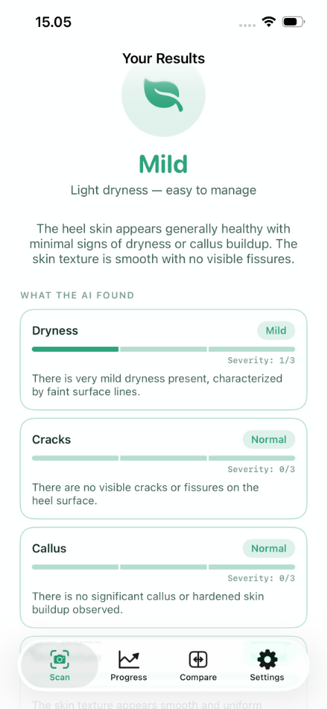 HeelFix Your Results Screen displaying AI findings